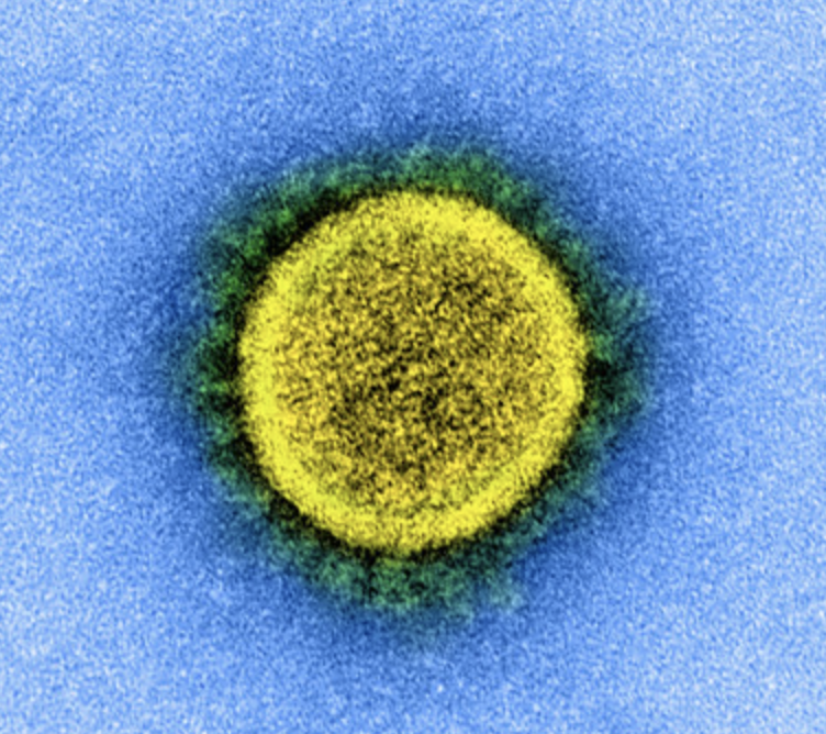 Transmission electron micrograph of a SARS-CoV-2 virus particle, isolated from a patient