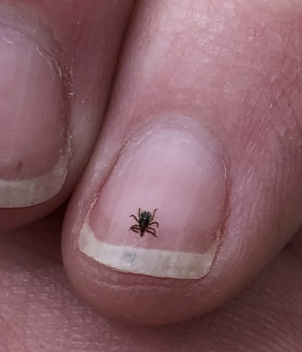 Small ticks on fingernail